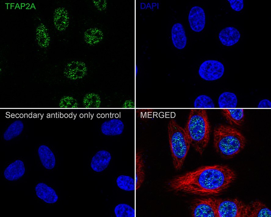 AP2 alpha Antibody (PSH02-06)
