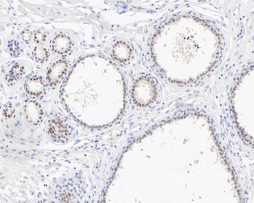 AP2 alpha Antibody (PSH02-06)