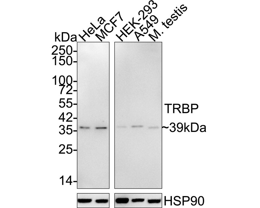 TRBP Antibody (JE34-99) Western Blot: TRBP Antibody (JE34-99) [NBP3-33046]