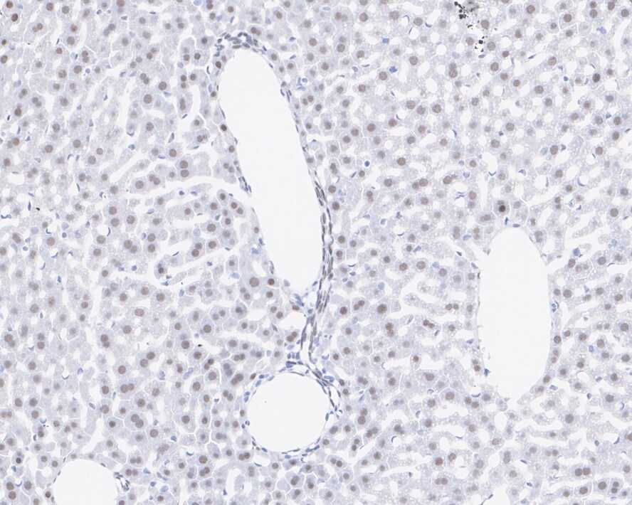 TRBP Antibody (JE34-99)
