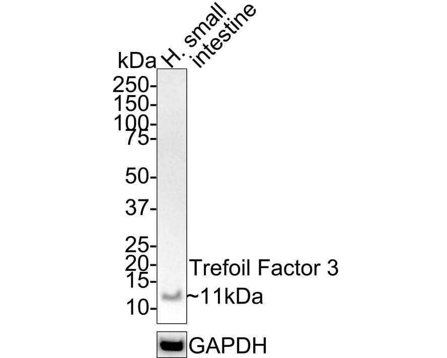TFF3 Antibody (JE32-01) Western Blot: TFF3 Antibody (JE32-01) [NBP3-33047]