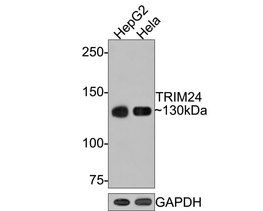 TIF1 alpha Antibody (JE64-31)