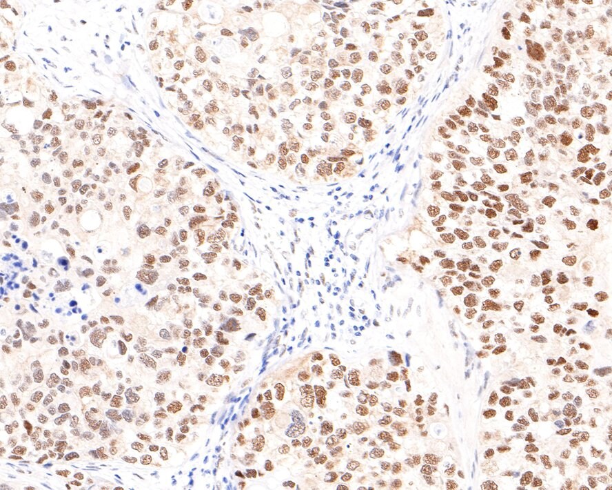 TIF1 alpha Antibody (JE64-31)