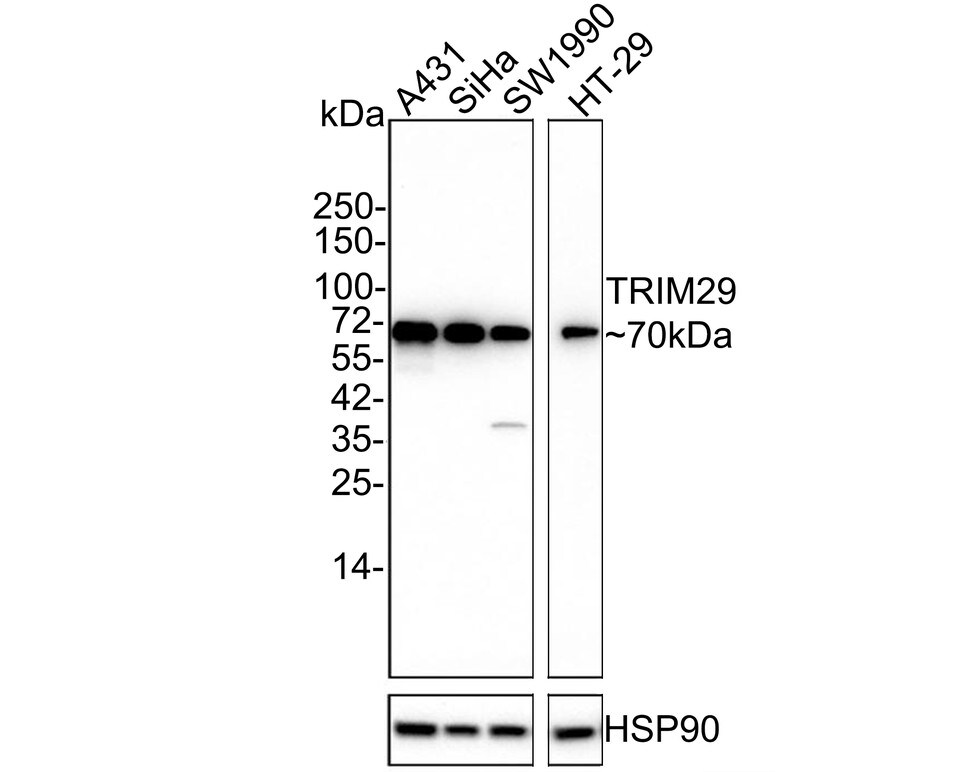 TRIM29 Antibody (PSH02-99) Western Blot: TRIM29 Antibody (PSH02-99) [NBP3-33054]
