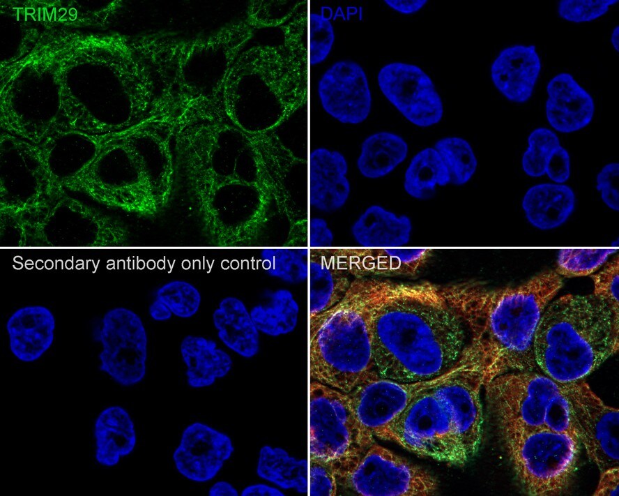 TRIM29 Antibody (PSH02-99)