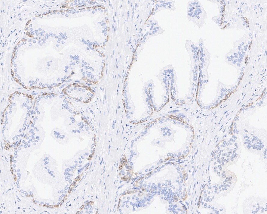 TRIM29 Antibody (PSH02-99)