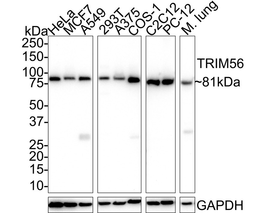 TRIM56 Antibody (PSH02-17) Western Blot: TRIM56 Antibody (PSH02-17) [NBP3-33055]
