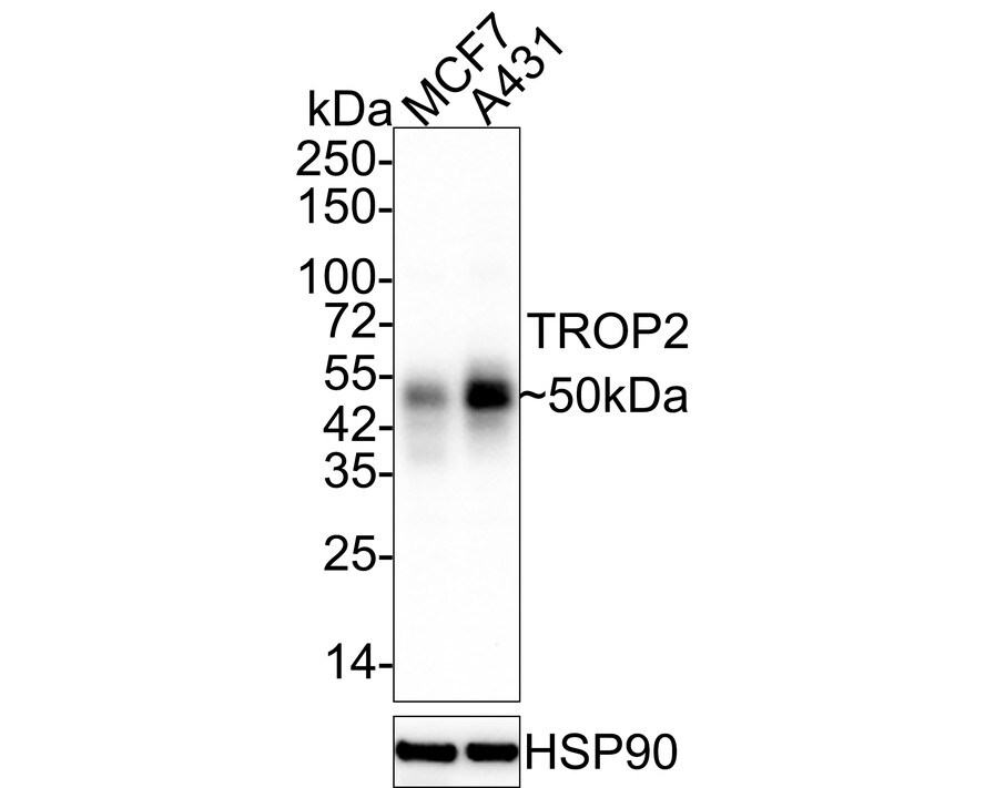 TROP-2 Antibody (A5E2-R) Western Blot: TROP-2 Antibody (A5E2-R) [NBP3-33058]
