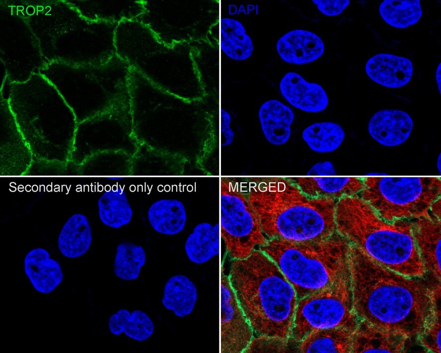 TROP-2 Antibody (A5E2-R)