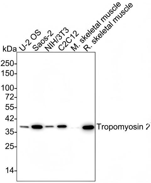 tropomyosin-2 Antibody (PSH02-63) Western Blot: tropomyosin-2 Antibody (PSH02-63) [NBP3-33059]