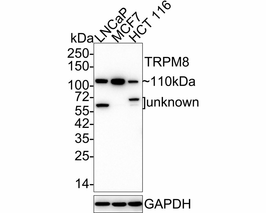 TRPM8 Antibody (JE32-58) Western Blot: TRPM8 Antibody (JE32-58) [NBP3-33062]