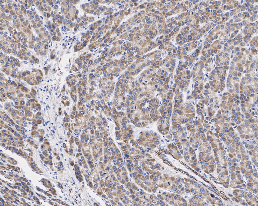 TRPM8 Antibody (JE32-58)