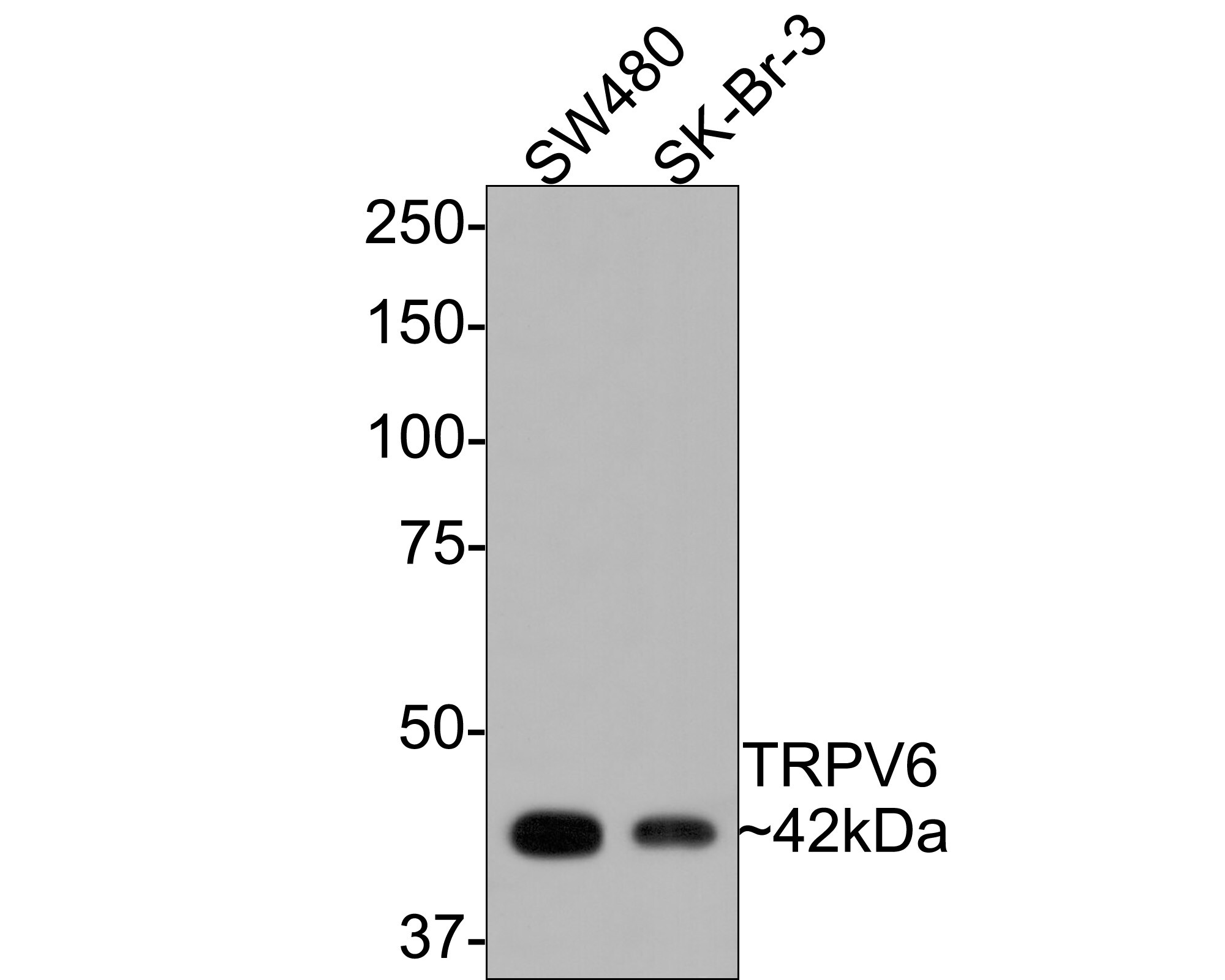 TRPV6 Antibody Western Blot: TRPV6 Antibody [NBP3-33063]