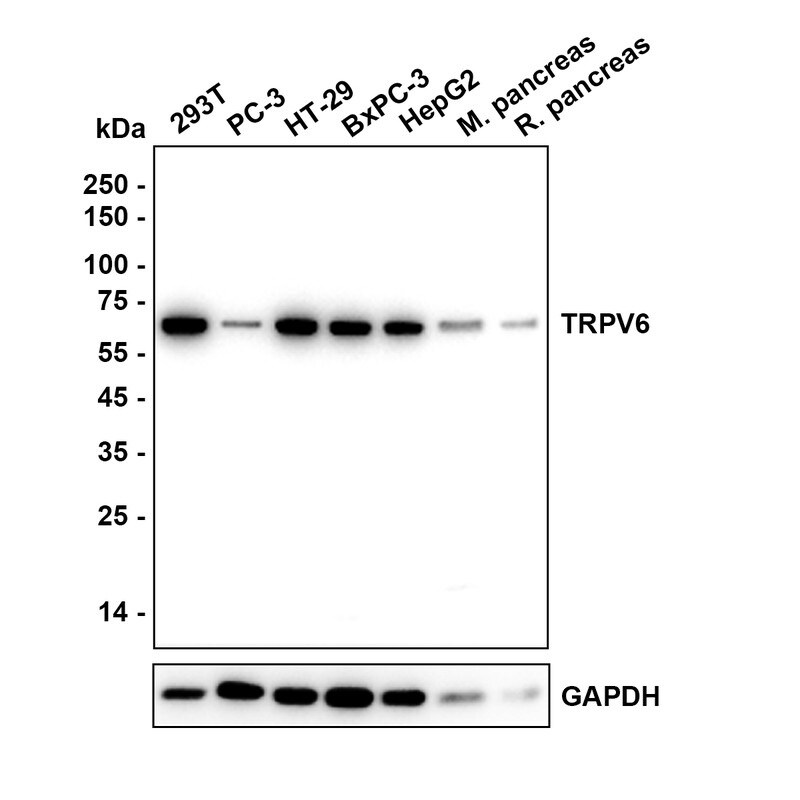 TRPV6 Antibody Western Blot: TRPV6 Antibody [NBP3-33063]