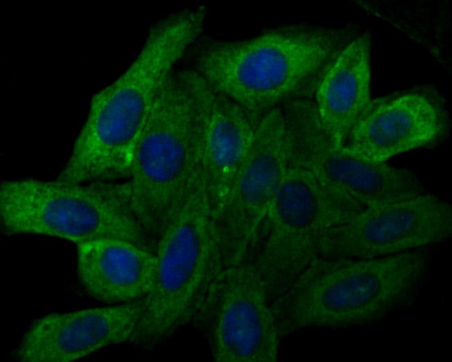 TRPV6 Antibody