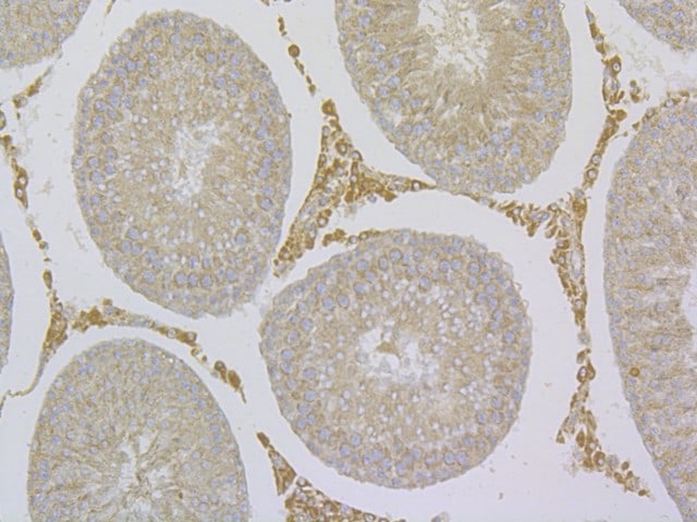 TRPV6 Antibody