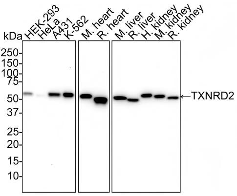 TXNRD2 Antibody (PSH02-26) Western Blot: TXNRD2 Antibody (PSH02-26) [NBP3-33068]