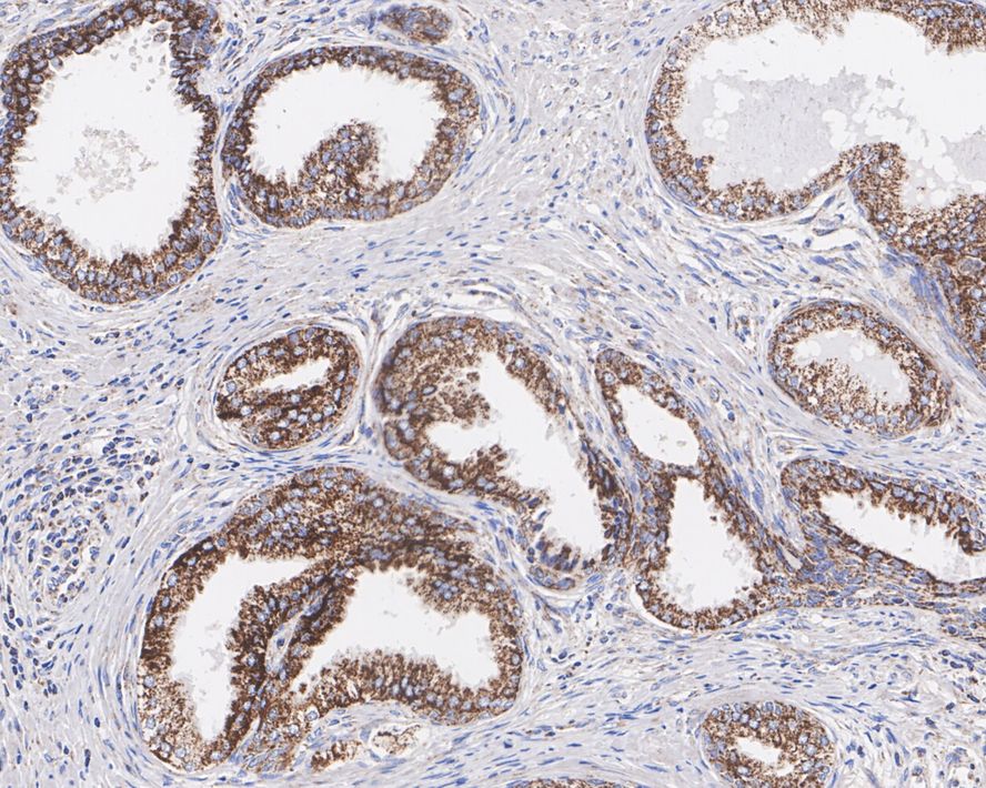 TXNRD2 Antibody (PSH02-26)