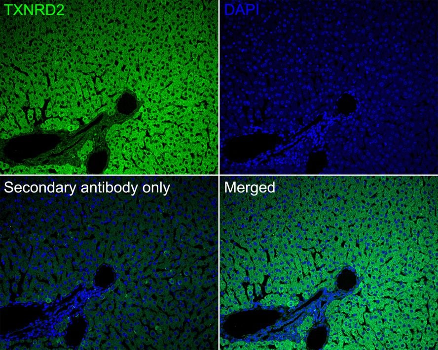 TXNRD2 Antibody (PSH02-26)