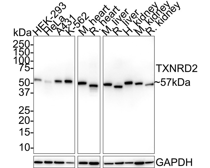 TXNRD2 Antibody (PSH02-27) Western Blot: TXNRD2 Antibody (PSH02-27) [NBP3-33069]