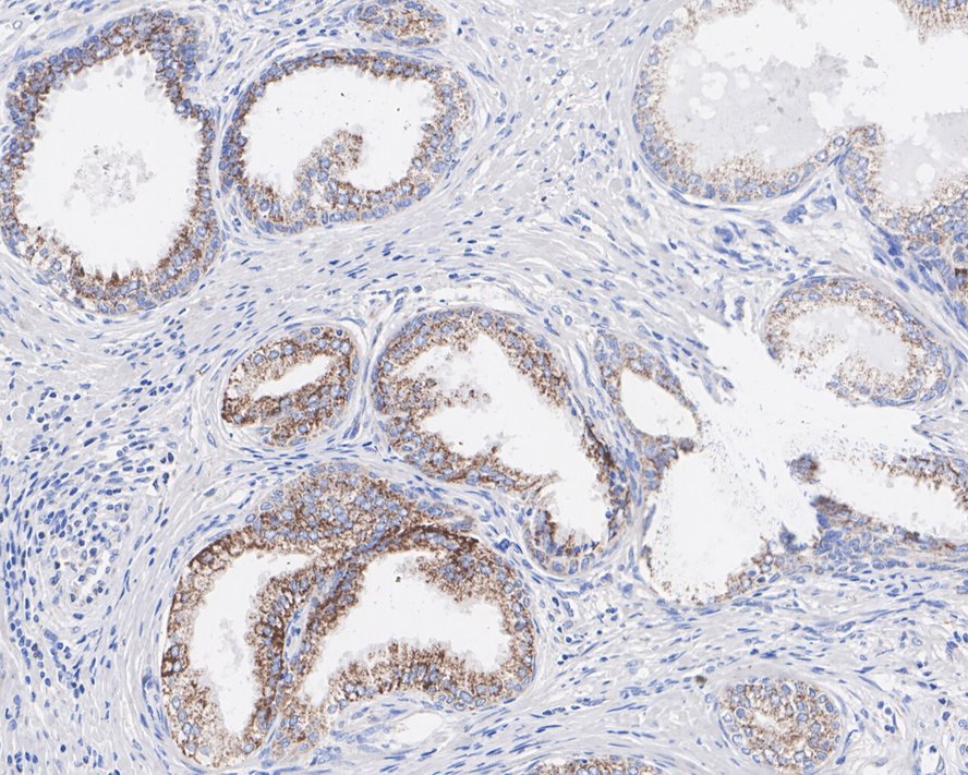 TXNRD2 Antibody (PSH02-27)