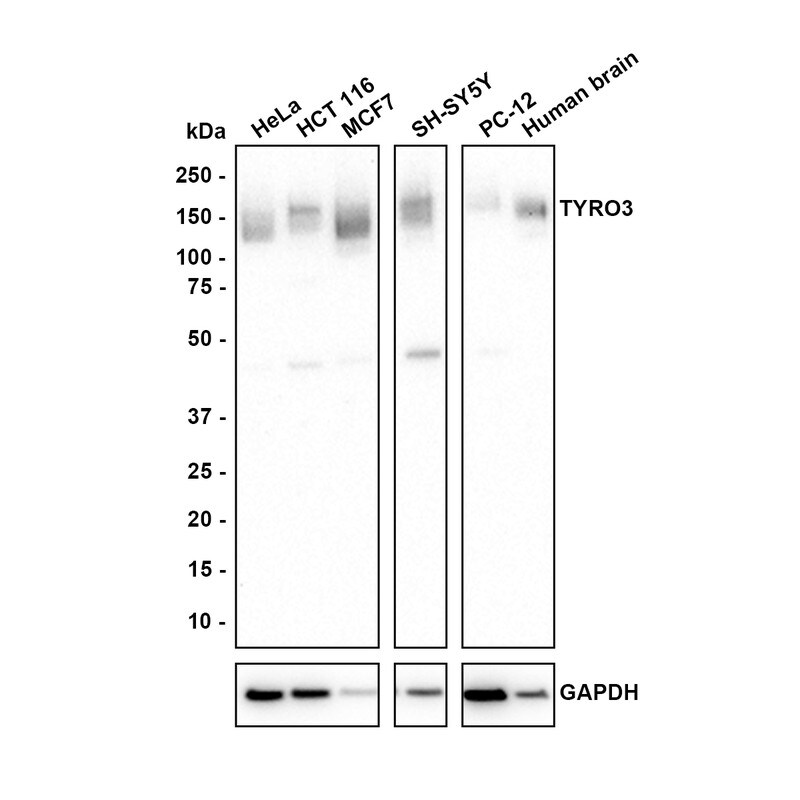 Dtk/TYRO3 Antibody (JE38-13) Western Blot: Dtk/TYRO3 Antibody (JE38-13) [NBP3-33070]