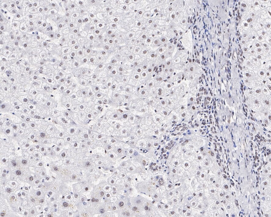 U2AF2 Antibody (JE36-33)