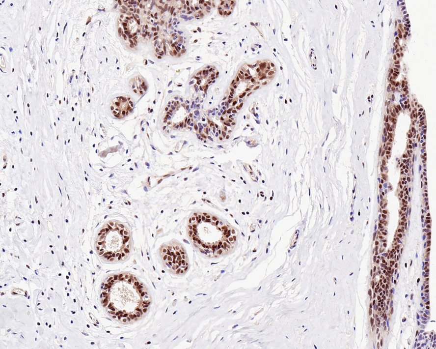 UBA3 Antibody (1B5-2-3-R)