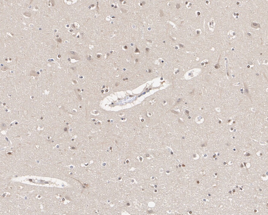 UBA3 Antibody (1C10-5-5-R)