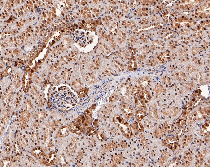 ISG15 Activating Enzyme/UBE1L Antibody (JE50-55)