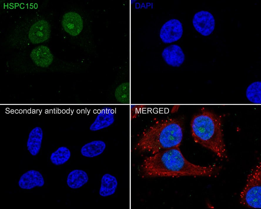 UBE2T Antibody (JE65-79)