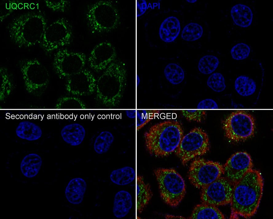 UQCRC1 Antibody (PSH01-23)