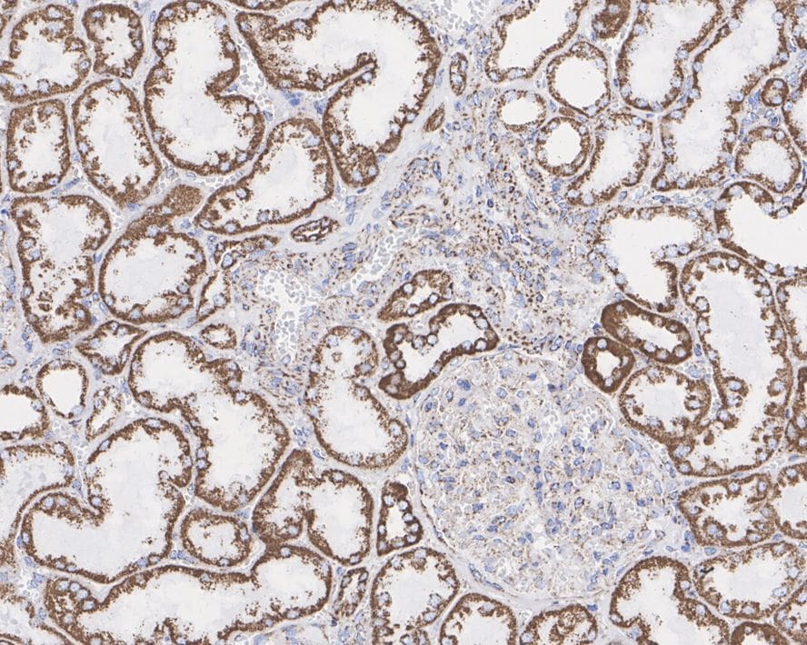UQCRC1 Antibody (PSH01-23)