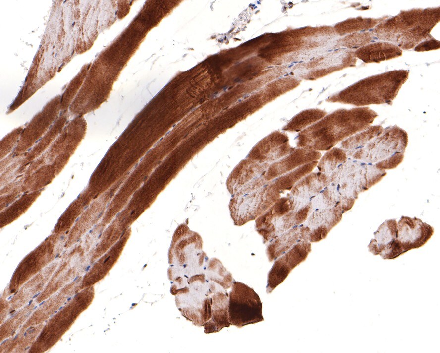 UFD1L Antibody (JE64-80)