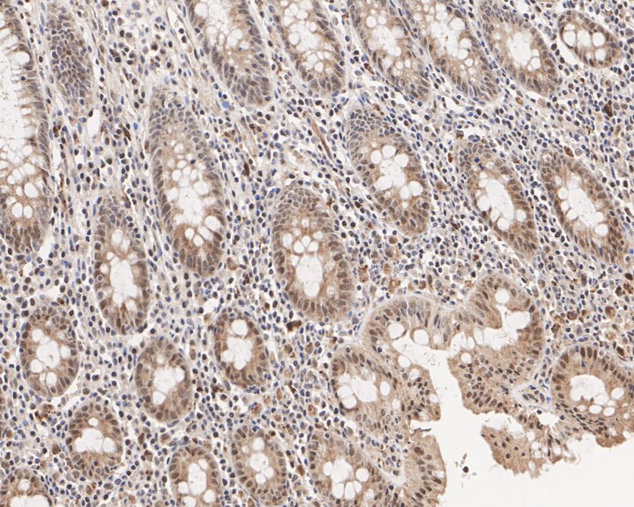 UFSP2 Antibody (PSH03-57)