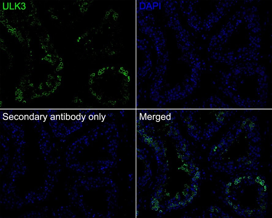 ULK3 Antibody (PSH01-09)