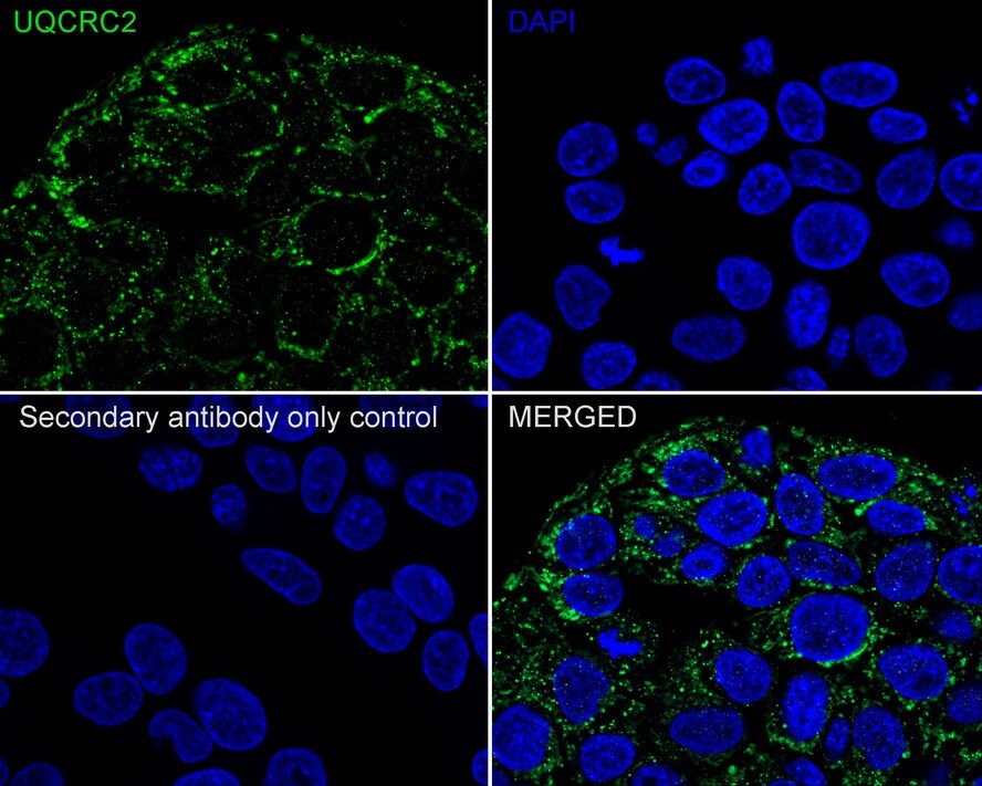 UQCRC2 Antibody (JE32-56)