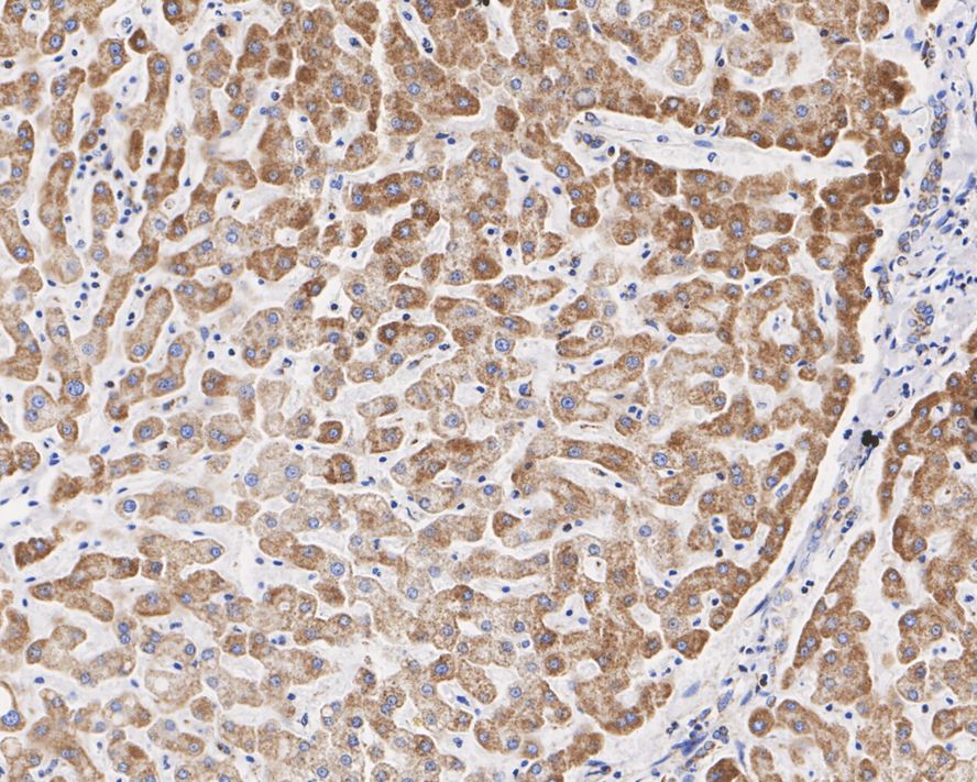 UQCRC2 Antibody (JE32-56)