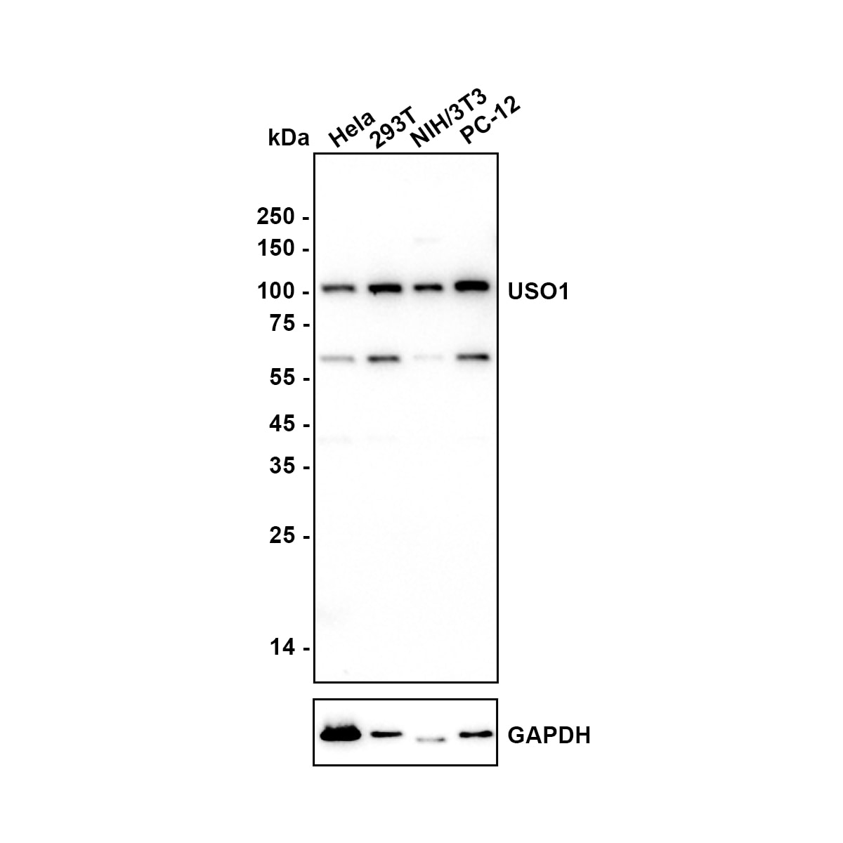 VDP p115 Antibody (JE64-48) Western Blot: VDP p115 Antibody (JE64-48) [NBP3-33087]