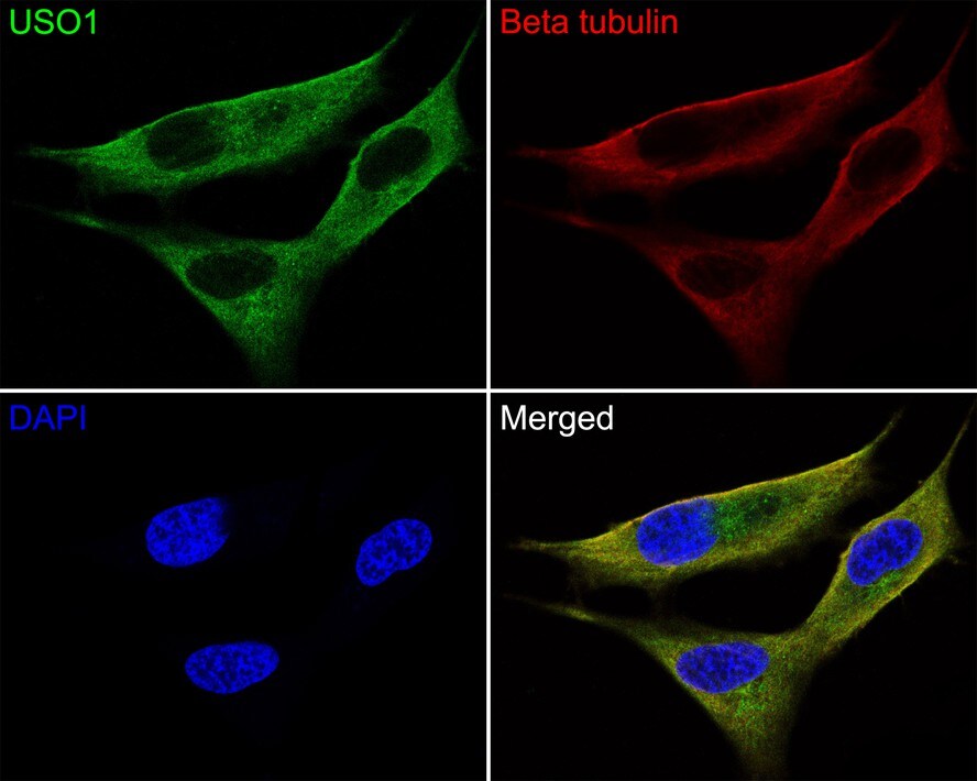 VDP p115 Antibody (JE64-48)