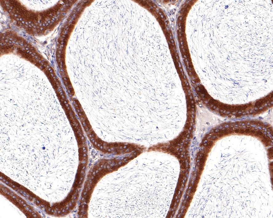 VDP p115 Antibody (JE64-48)