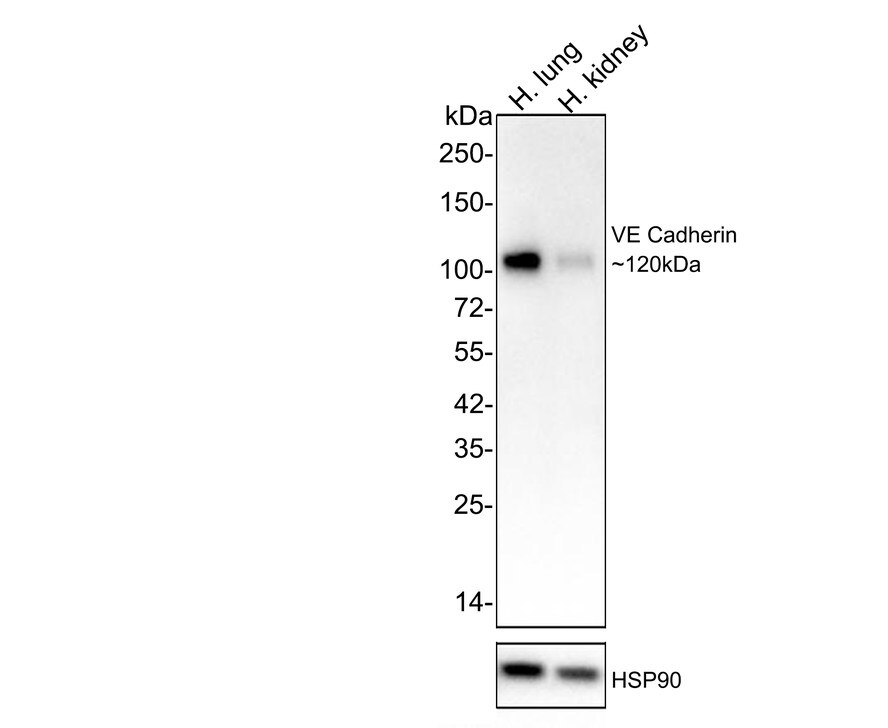 VE-Cadherin Antibody (PSH03-15) Western Blot: VE-Cadherin Antibody (PSH03-15) [NBP3-33088]
