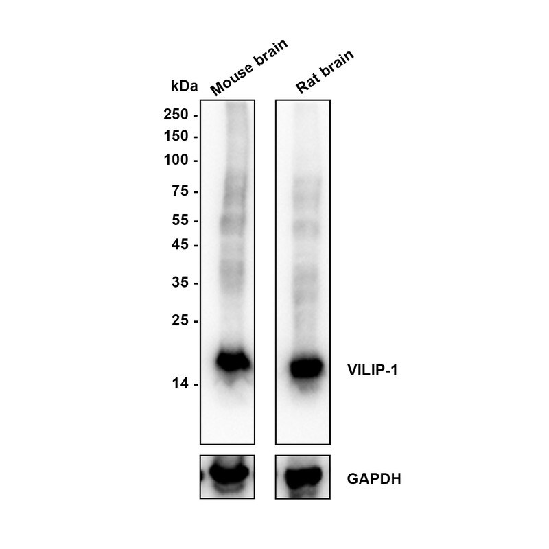 visinin-like 1 Antibody (PSH0-08) Western Blot: visinin-like 1 Antibody (PSH0-08) [NBP3-33089]