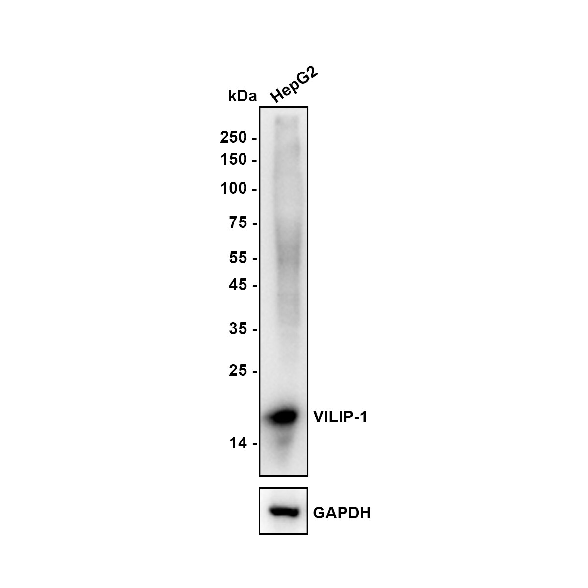 visinin-like 1 Antibody (PSH0-08) Western Blot: visinin-like 1 Antibody (PSH0-08) [NBP3-33089]