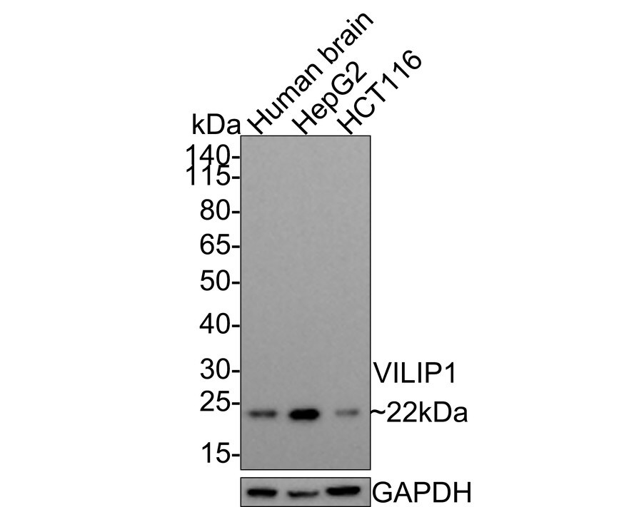 visinin-like 1 Antibody (PSH0-08)