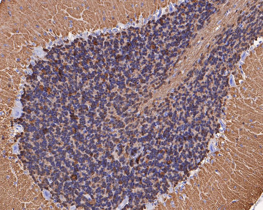 visinin-like 1 Antibody (PSH0-08)