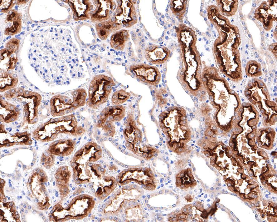 Villin 1 Antibody (A2)