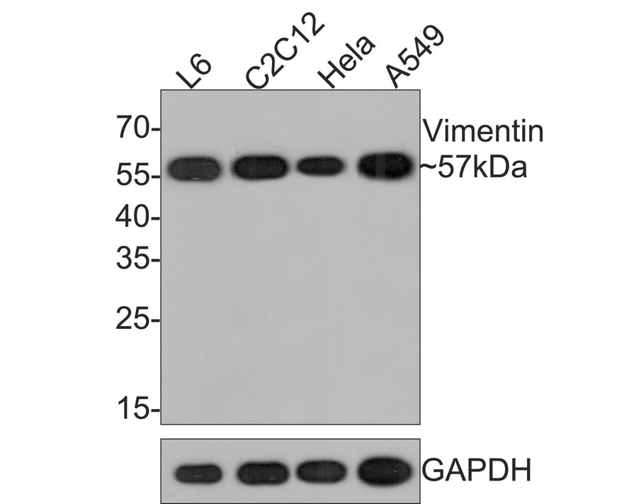 Vimentin Antibody (PDH0-01)