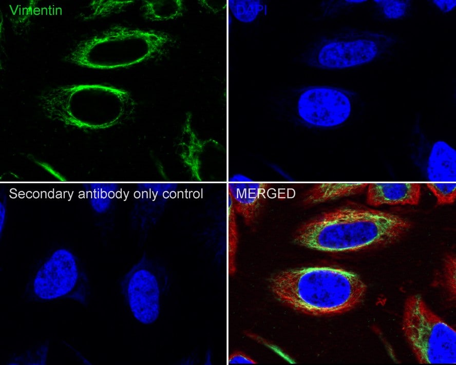 Vimentin Antibody (PDH0-01)
