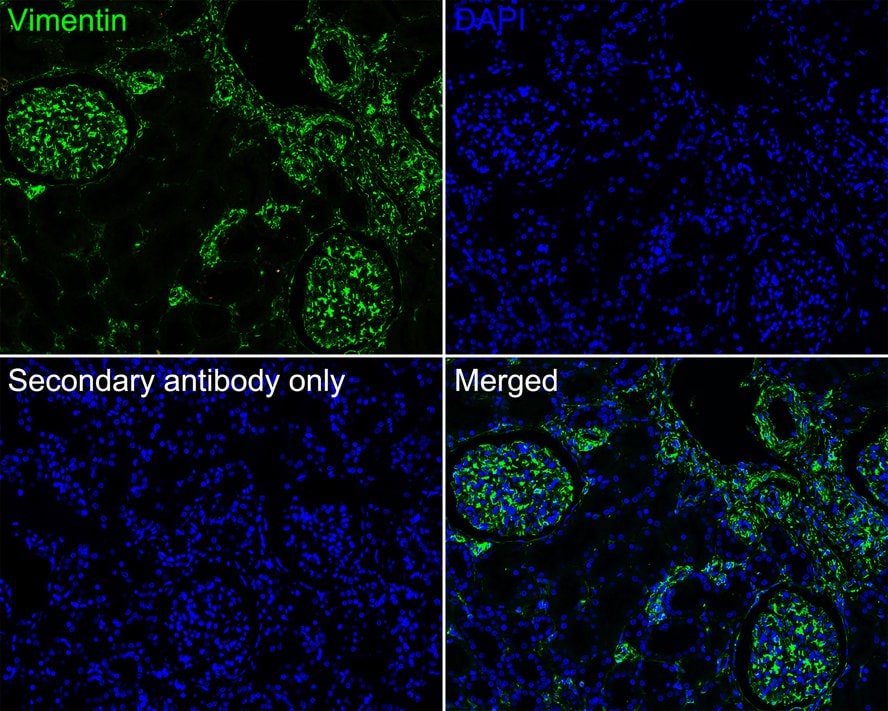 Vimentin Antibody (PDH0-01)